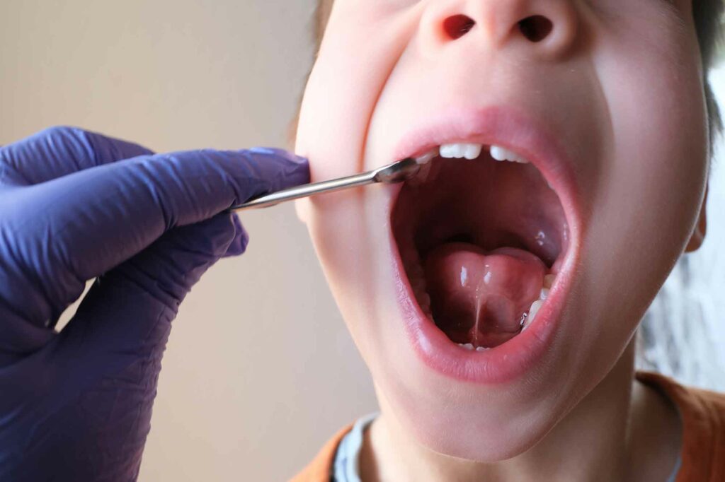 dentist looking in a child's open mouth