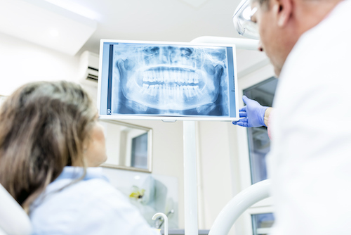 Digital x-rays at Broad Smiles Pediatric Dentistry.