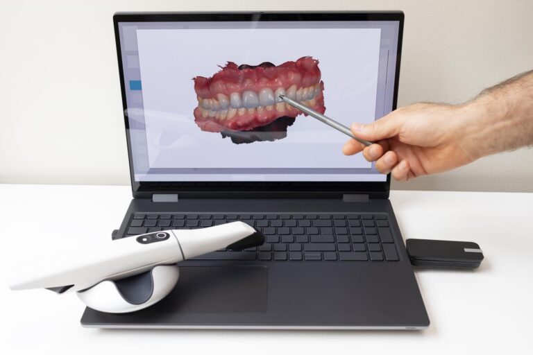 Intraoral scanner technology at Broad Smiles Pediatric Dentistry.